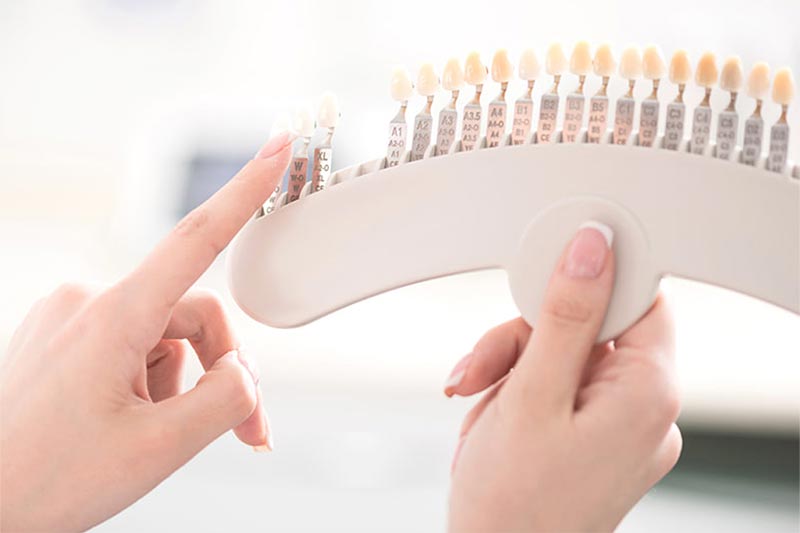 ホワイトニング