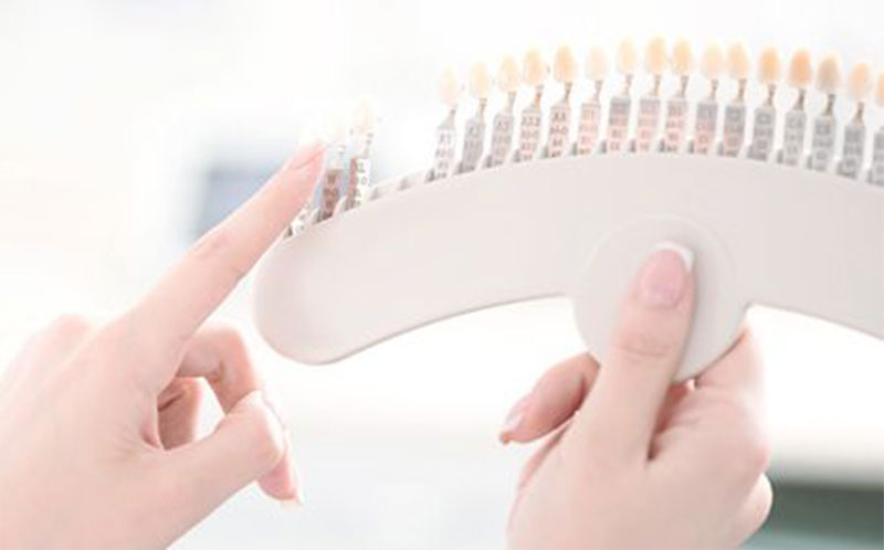 ホワイトニング