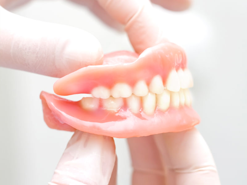 入れ歯(義歯)