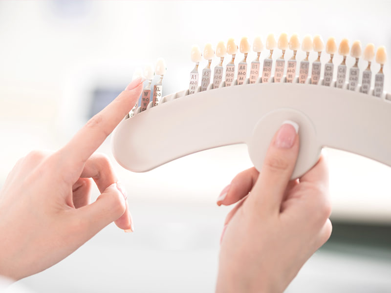 ホワイトニング