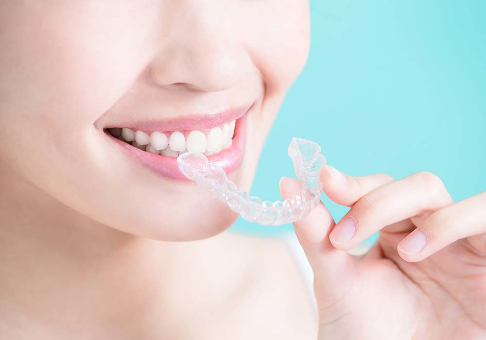 矯正歯科・小児矯正