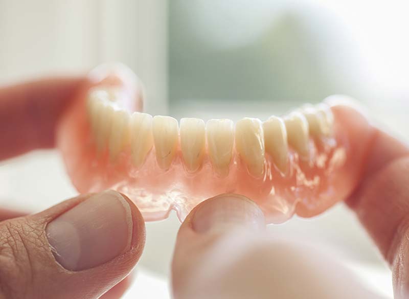 入れ歯（義歯）