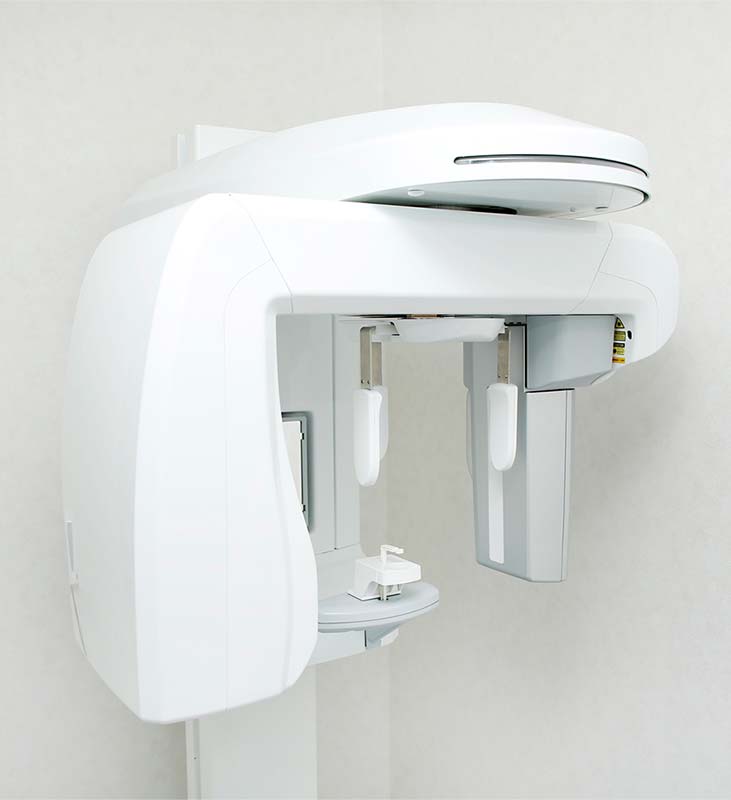 デジタルレントゲン