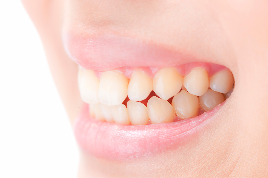 かみ合わせが一番大切